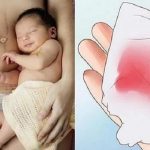 Phân biệt giữa chu kỳ kinh nguyệt và sản dịch sau sinh mổ?