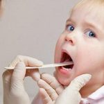 Nên cắt amidan cho trẻ ở độ tuổi nào ?