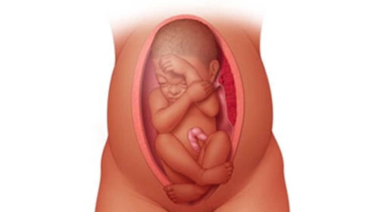 Mẹ bầu lo lắng: Tại sao có những thai nhi không quay đầu?