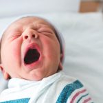 Bệnh cam ở trẻ sơ sinh: Những dấu hiệu và cách điều trị hiệu quả