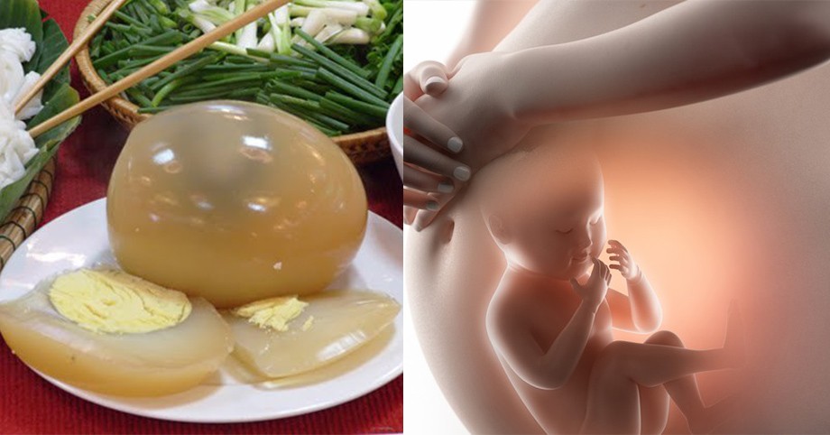 Thực hư thông tin ăn trứng ngỗng khi mang thai giúp trẻ có làn da mịn màng