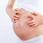 Viêm da cơ địa khi mang thai và cách điều trị an toàn, mau khỏi