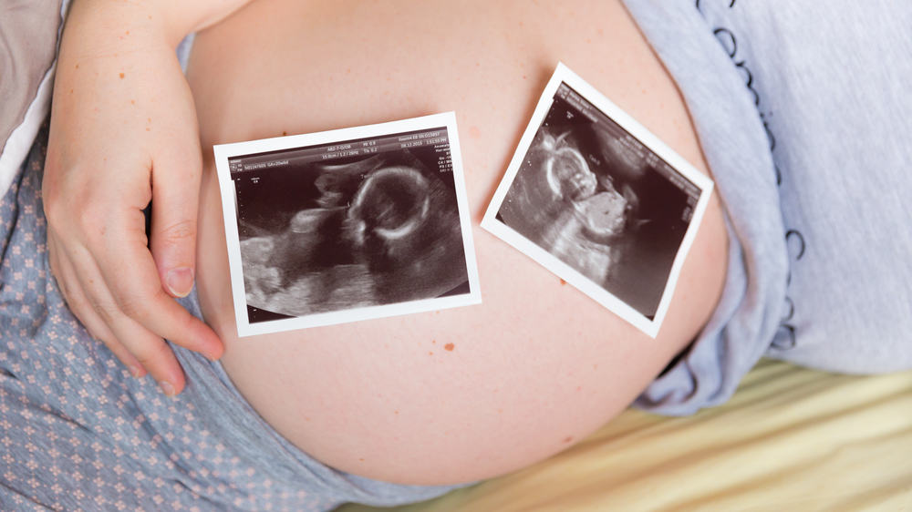 Sinh đa thai là gì? Những điều mà mẹ cần biết về sinh đa thai?