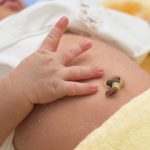 Rốn trẻ sơ sinh rỉ dịch: Nhận biết và cách chăm sóc an toàn cho trẻ