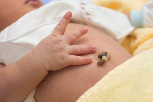Rốn trẻ sơ sinh rỉ dịch: Nhận biết và cách chăm sóc an toàn cho trẻ