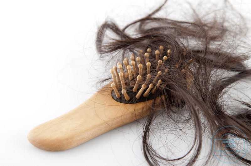 Những điều mẹ nên và không nên làm khi bị rụng tóc sau sinh