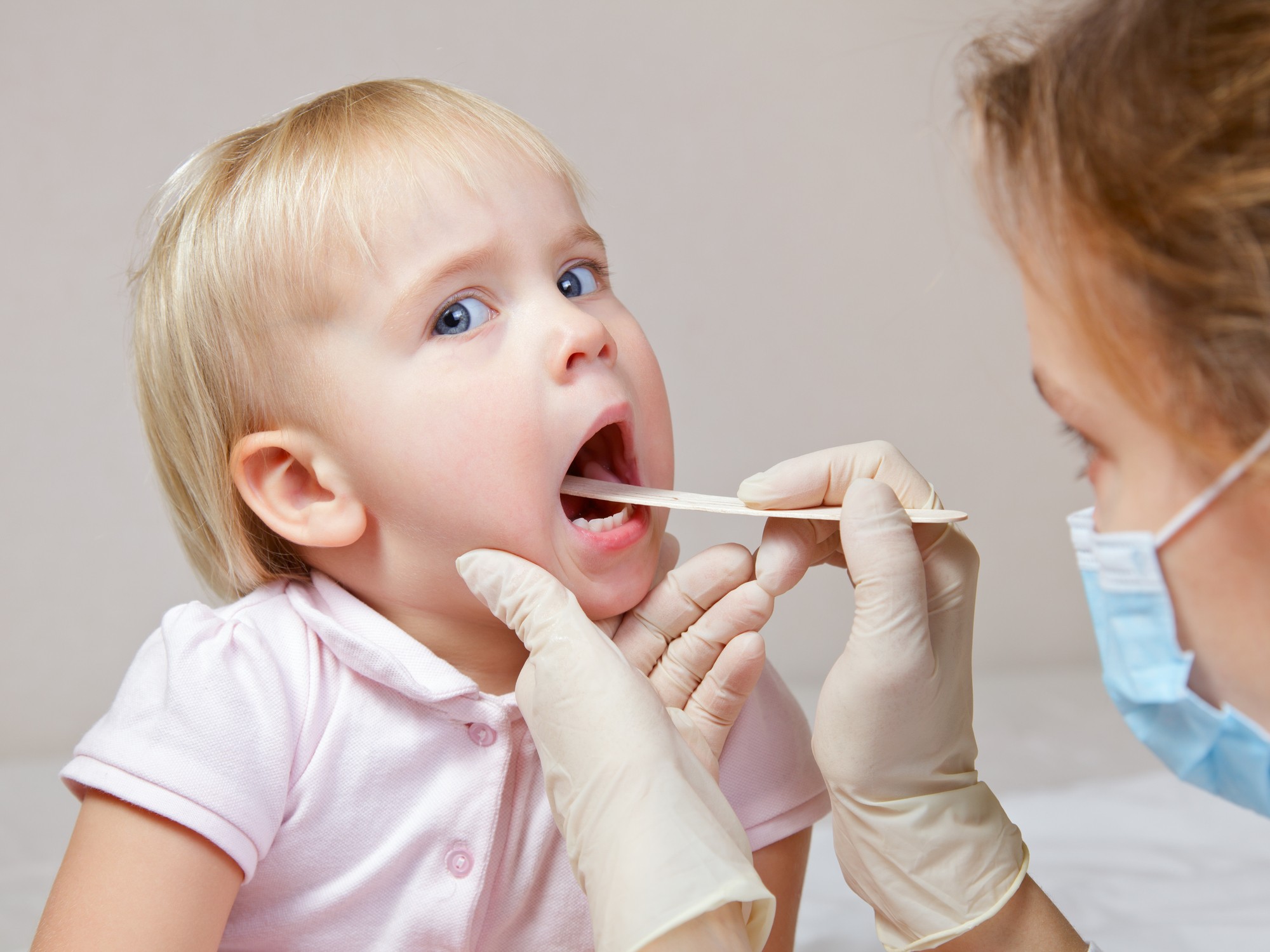 Осмотр зева ребенка. Золотистый стафилококк в носу у ребенка. Осмотр полости рта у детей. Стрептотест.