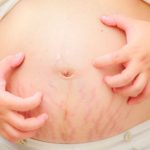 Ứ mật thai kỳ ảnh hưởng như thế nào đến sức khỏe của mẹ và bé?