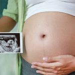 Dấu hiệu cho thấy bà bầu đang thiếu nước ối, các phương pháp tăng cường nước ối