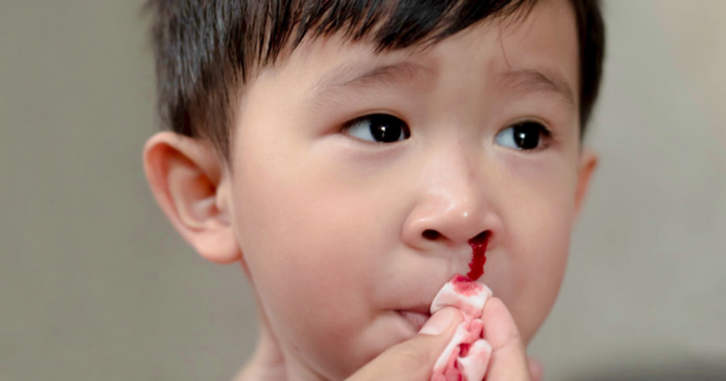 Bệnh máu khó đông ở trẻ em và những điều cần biết