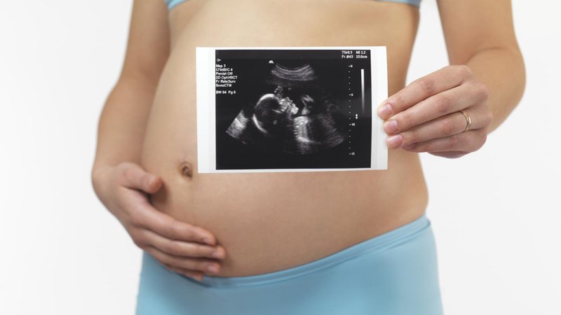 Siêu âm Doppler thai nhi và những điều mẹ bầu cần biết