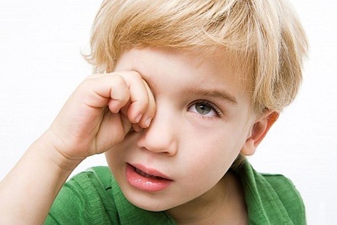 Bệnh khô mắt ở trẻ: Triệu chứng và cách điều trị