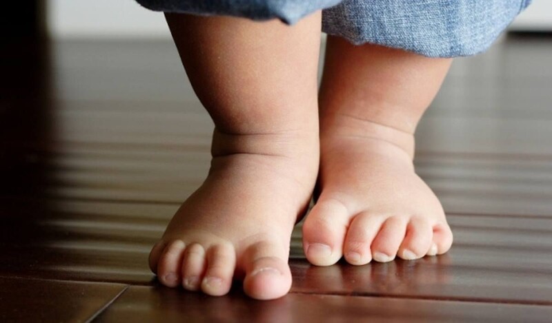 Dấu hiệu nhận biết trẻ đang mắc hội chứng bàn chân bẹt, cha mẹ nên biết sớm