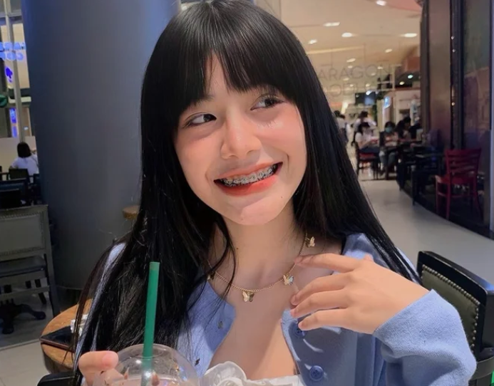 Niềng răng lên ngôi: Từ chỉnh nha y khoa đến 'phụ kiện' thời trang Gen Z săn đón