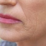 4 vấn đề da “khó tránh” sau tuổi 40 và cách cải thiện hiệu quả tại nhà