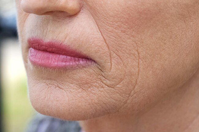 4 vấn đề da “khó tránh” sau tuổi 40 và cách cải thiện hiệu quả tại nhà