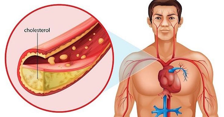 5 loại thực phẩm thân thiện với tim mạch – Giải pháp cho người có cholesterol cao