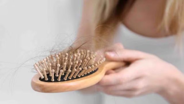 Rụng tóc khi tắm gội: Dấu hiệu tự nhiên hay cảnh báo sức khỏe?