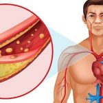 Ăn uống đúng cách giúp giảm cholesterol và ngăn ngừa bệnh tim