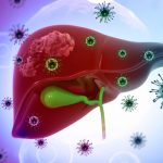 Viêm Gan B Và C Khác Nhau Thế Nào? Những Điều Cần Biết Để Bảo Vệ Lá Gan