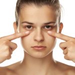 Vì sao bôi kem mắt mãi vẫn không hết quầng thâm?